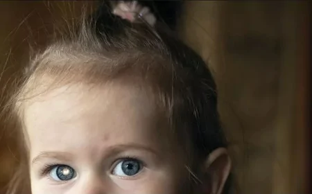 Retinoblastoma: atenção ao reflexo branco nos olhos das crianças