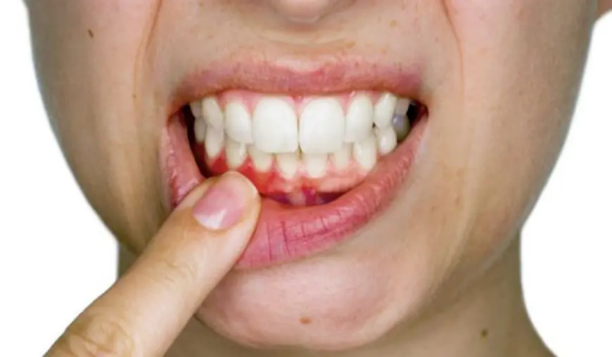 Sorriso em risco? Os efeitos silenciosos do Mounjaro nos dentes que você precisa conhecer